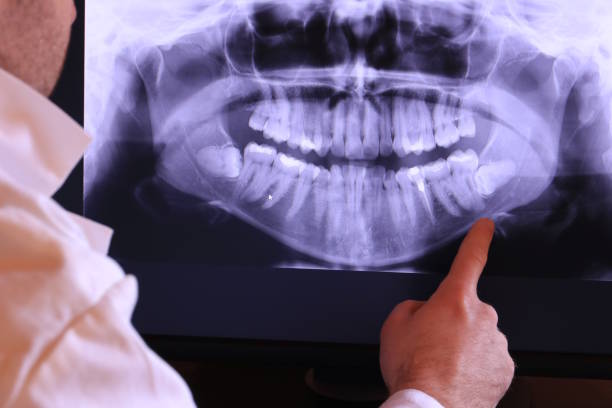 Dentist for Dental Trauma in WI